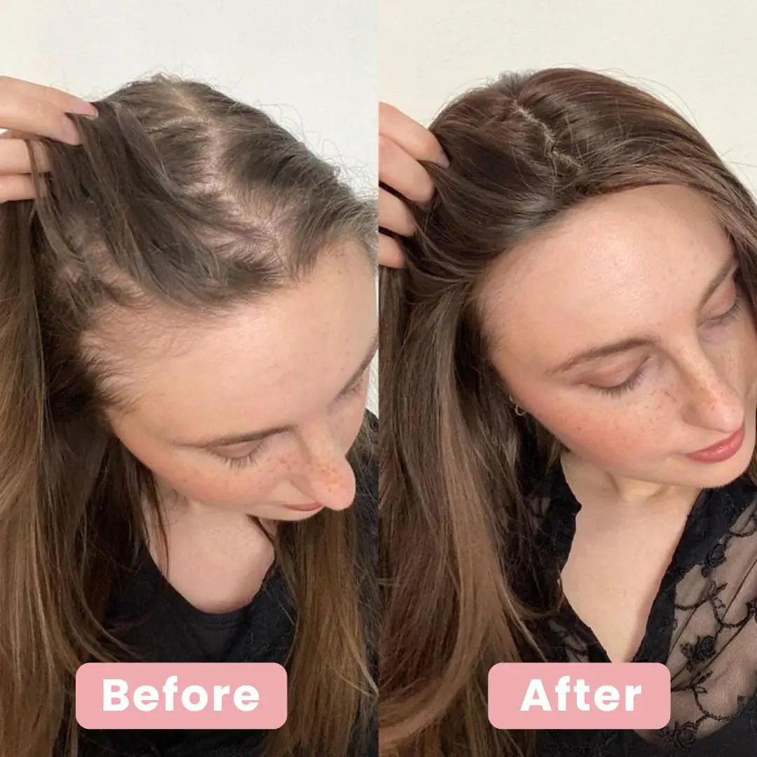 4 in 1 Hair Renewal Brush - SilkTrim