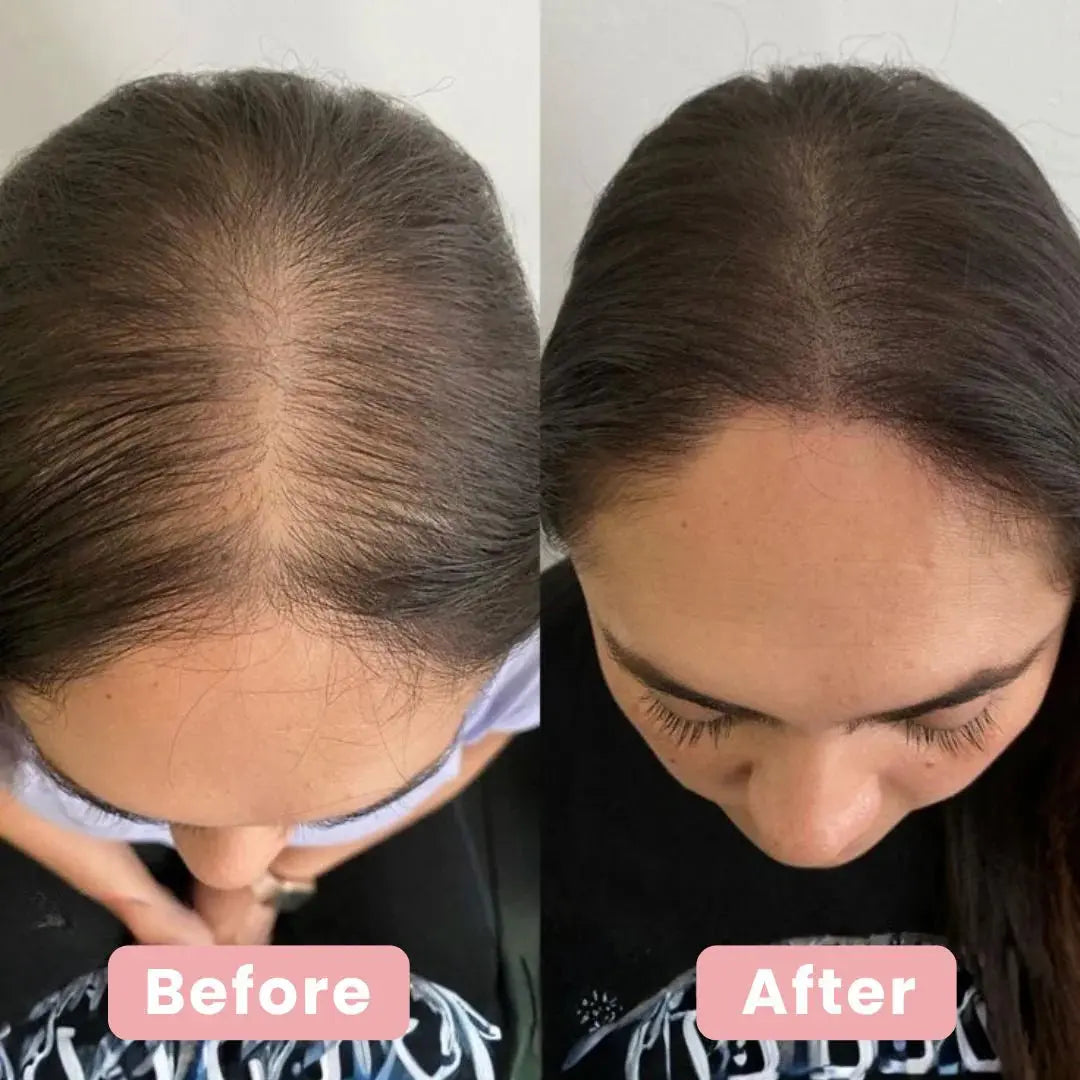 4 in 1 Hair Renewal Brush - SilkTrim