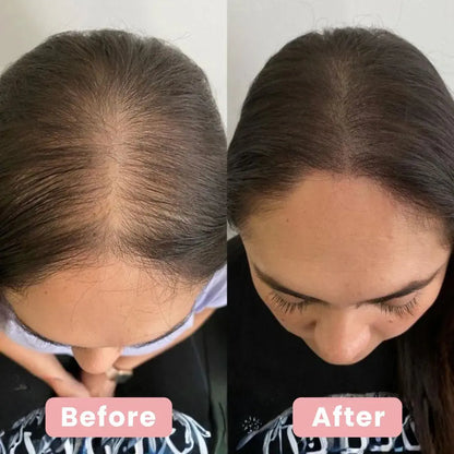 4 in 1 Hair Renewal Brush - SilkTrim